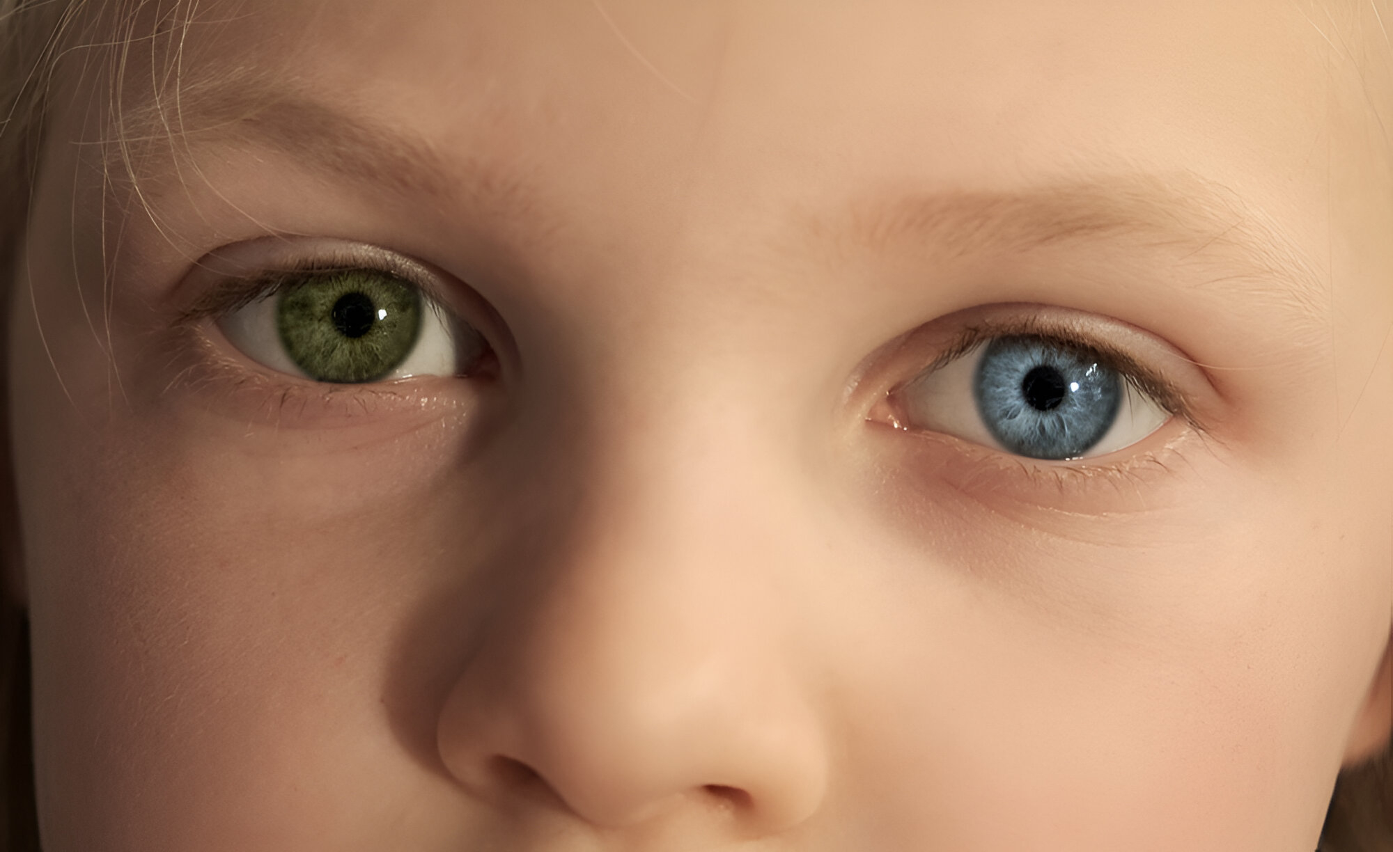 Double the Color, Double the Mystery: The Truth About Heterochromia