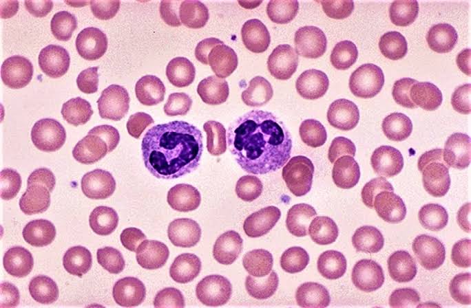 Unlocking the Microscopic World: A Guide to Leishman Stain in Laboratory Diagnostics