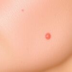 Group logo of Dermatology