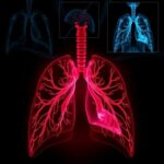 Group logo of Pulmonary Medicine