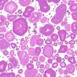Group logo of Oncopathology