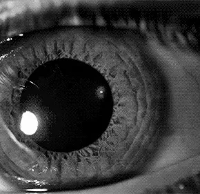eyes-with-dilated-pupil-3ya1ofysf4ijw5f8 